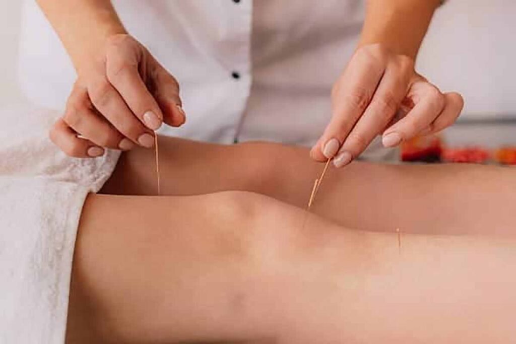Acupuncture Doctor in Madurai