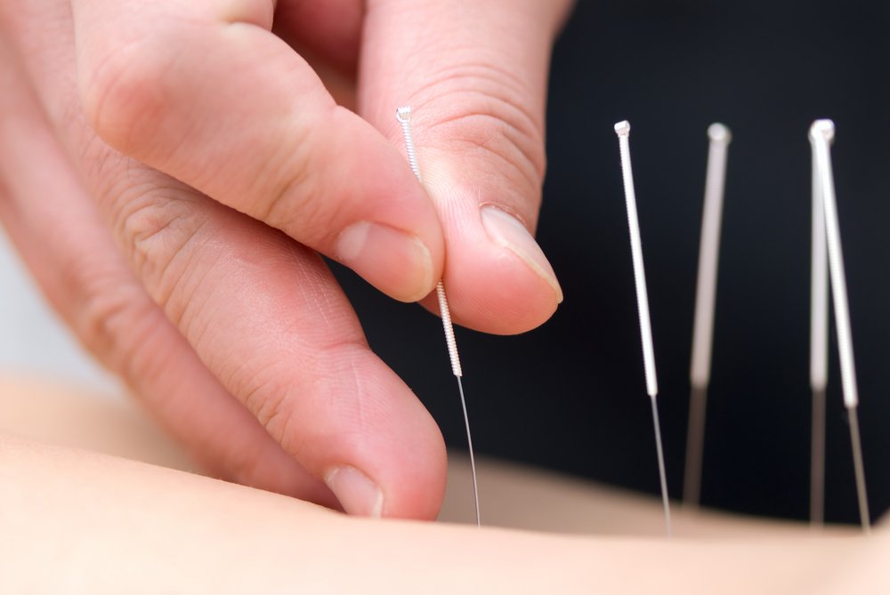 Acupuncture Clinic in Madurai